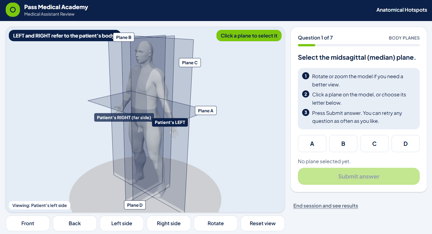 Anatomical hotspots on a 3D model